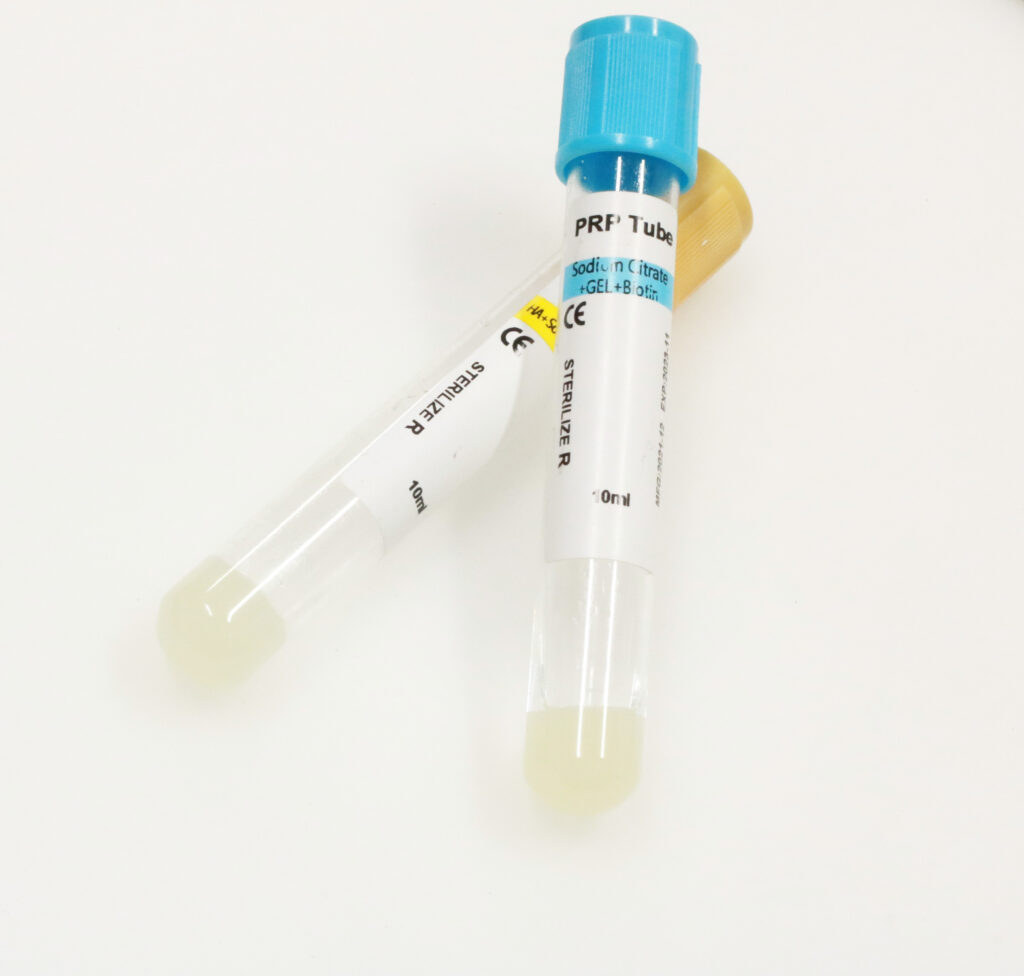 Sodium citrate tube