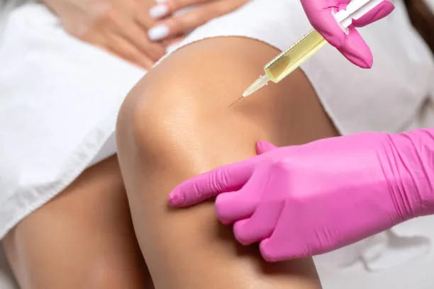 prp-for-keen-treatment