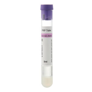 PRP Work for Hair Loss