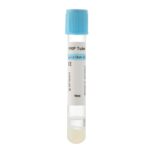 10ml Sodium Citrate Gel PRP Tube