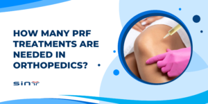 How Many PRF Treatments Are Needed in Orthopedics?