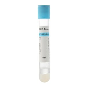 PRP Treatment