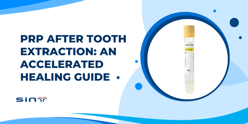 PRP After Tooth Extraction: An Accelerated Healing Guide