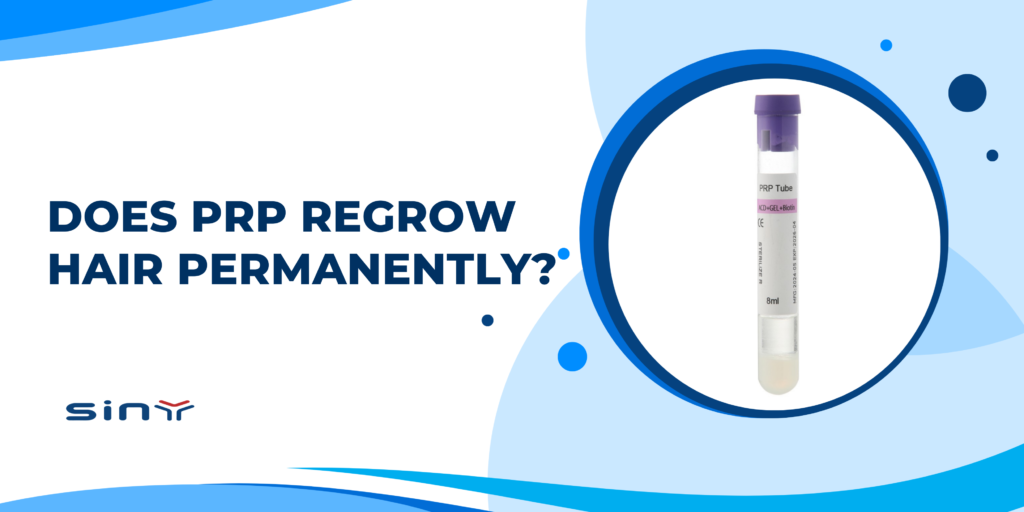 Does PRP Regrow Hair Permanently?
