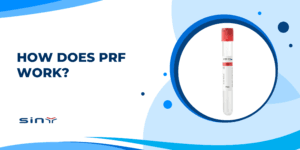 How Does PRF Work?