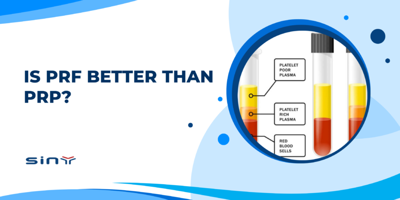 Is PRF Better Than PRP?