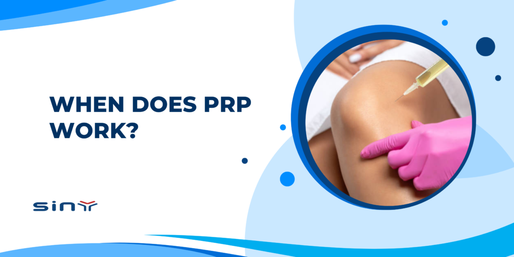 When Does PRP Work?