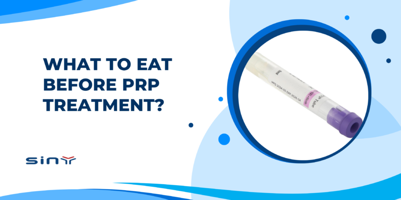 What to Eat Before PRP Treatment?