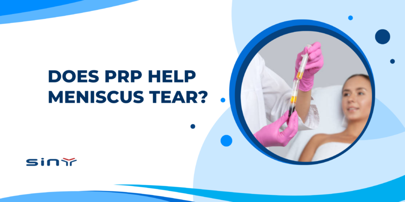 Does PRP Help Meniscus Tear?