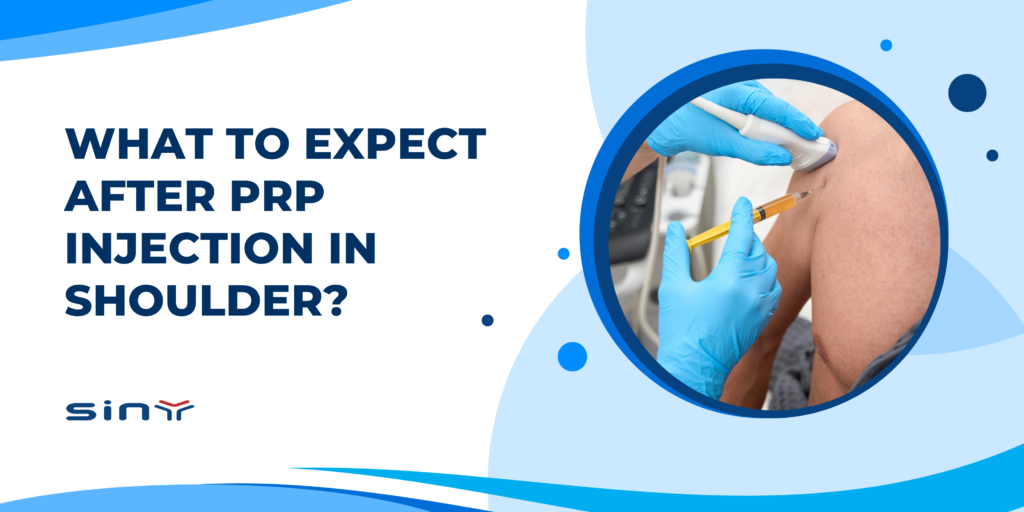 What to Expect After PRP Injection in Shoulder