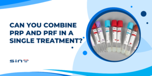 Can You Combine PRP and PRF in a Single Treatment