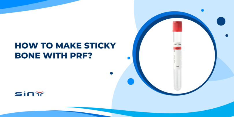 How to Make Sticky Bone with PRF