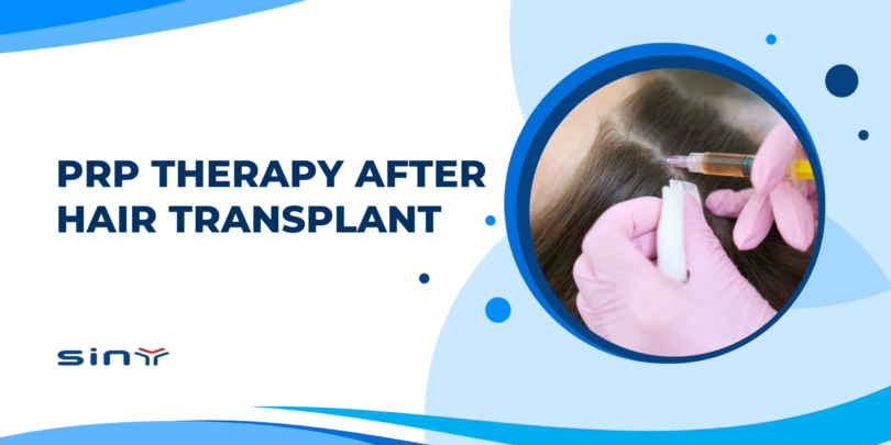 PRP Therapy After Hair Transplant